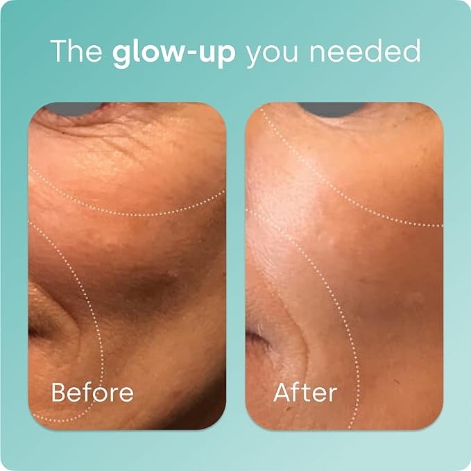 SuperMart Biosil Collagen Booster Supplement - 120 Original Capsules - Patented ch-OSA Activator for Skin, Hair, Nails & Joints - Supports Natural Production